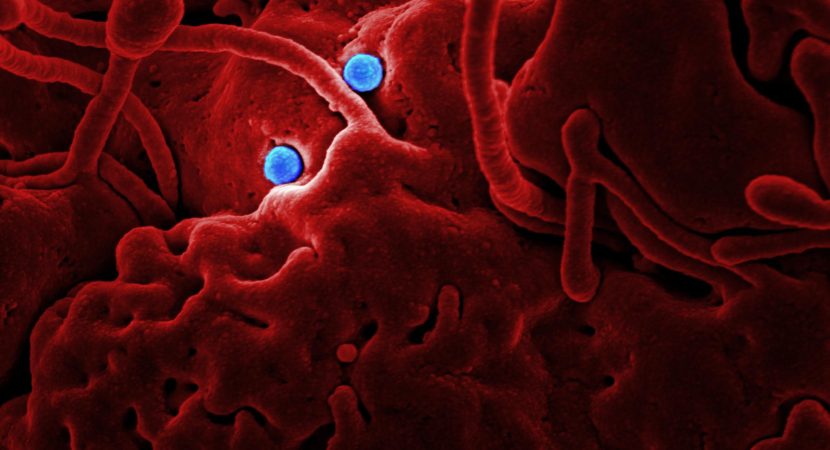 Alerta sanitaria en Chile: Casos de sífilis alcanzan récord histórico con fuerte alza en adultos mayores